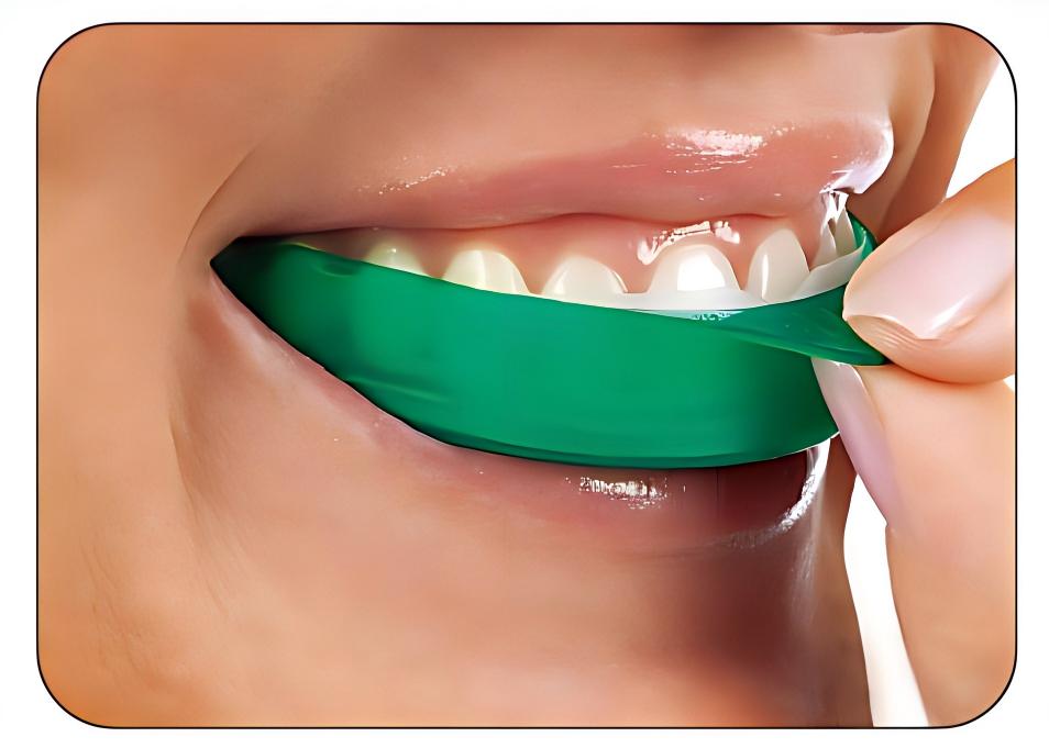 Teeth Whitening Opalescence Go - แผ่นฟอกสีฟันอัลตร้าเดนท์ โอพาเลสเซนซ์ โก 6% HP กลิ่นมิ้นท์