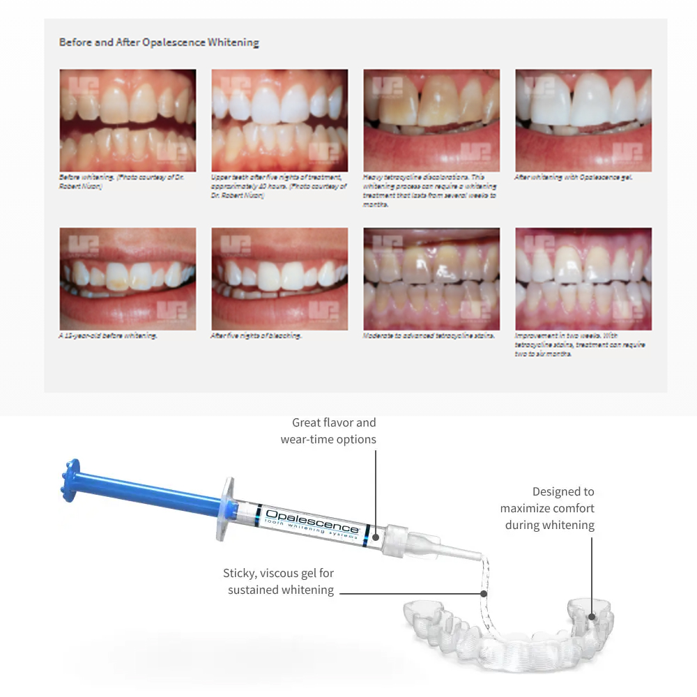 20% pF 20 16ชุดเจล8x1.2มล. ชุด - Teeth Whitening Led Kit บทวิจารณ์และราคา