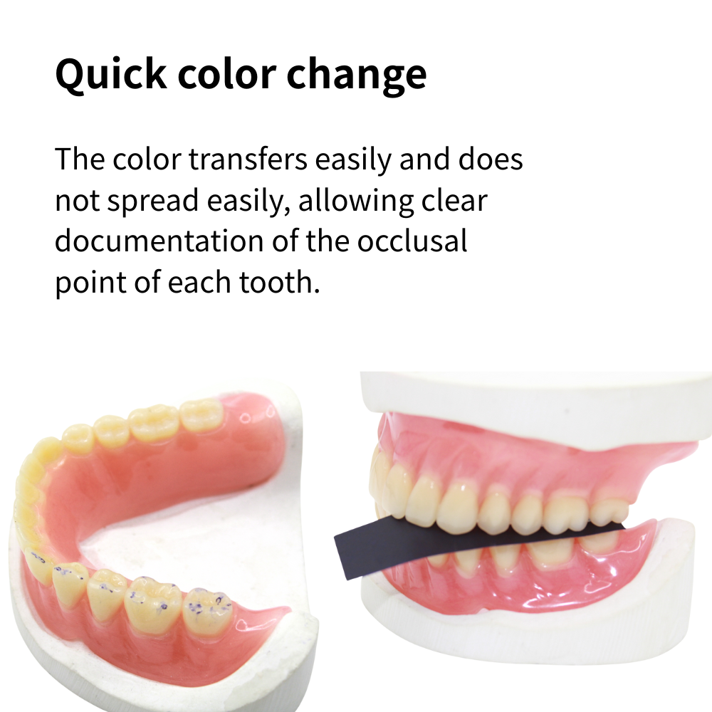 กระดาษเชื่อมฟัน AG 300 แผ่น/กล - Teeth Whitening Strips Permanent บทวิจารณ์และราคา