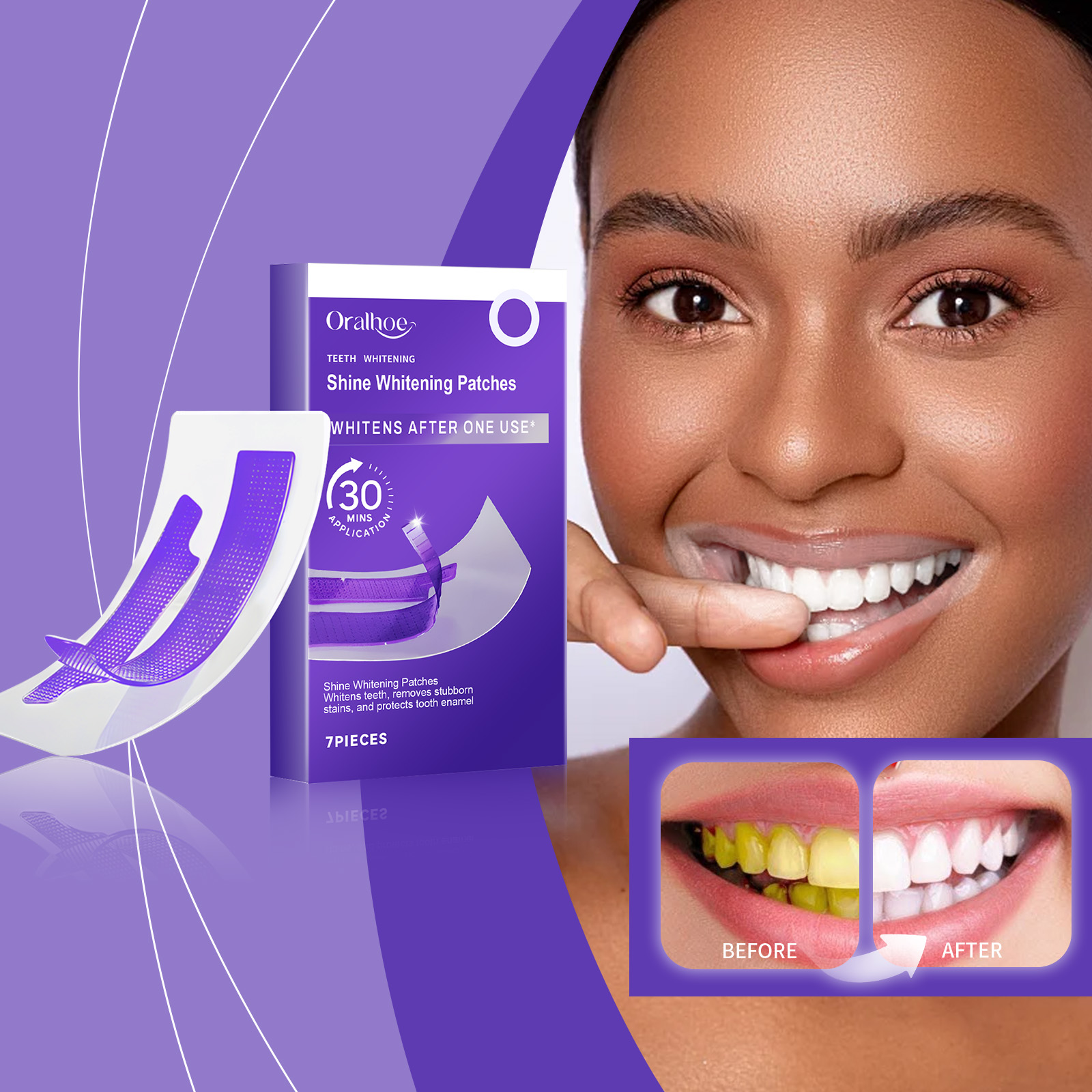 แผ่นฟอกสีฟันสีม่วง – ขจัดคราบพ - Teeth Whitening Strips Permanent บทวิจารณ์และราคา