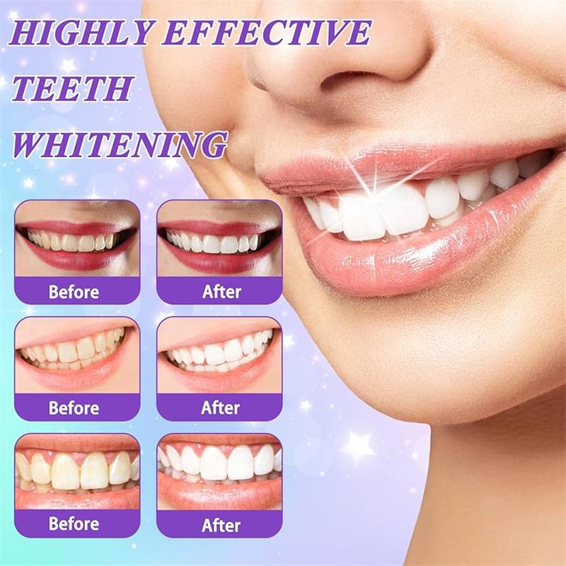 ยาสีฟันมูสฟอกสีฟัน 9D สีม่วง ข - Teeth Whitening Naturally บทวิจารณ์และราคา
