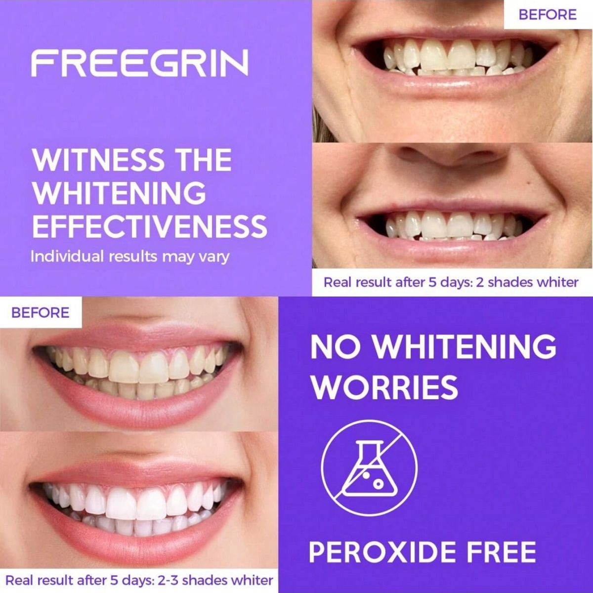 ดีลักซ์สติกเกอร์ฟอกสีฟัน 7/14/ - Teeth Whitening Strips Permanent บทวิจารณ์และราคา